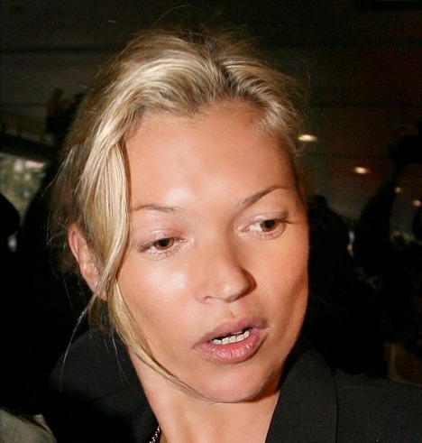 kate_moss_dopo